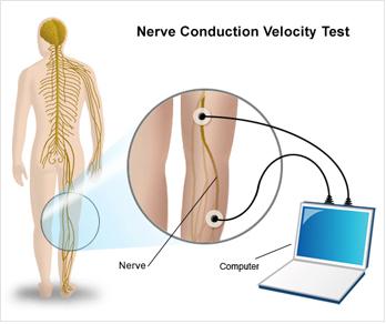 spectrum neurology group nerve conduction velocity