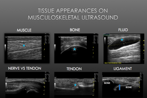 spectrum neurology group tissue appearance on musculoskeletal ultrasound